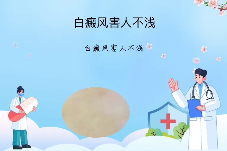 白癜风害人不浅