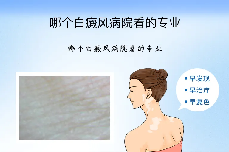哪个白癜风病院看的专业