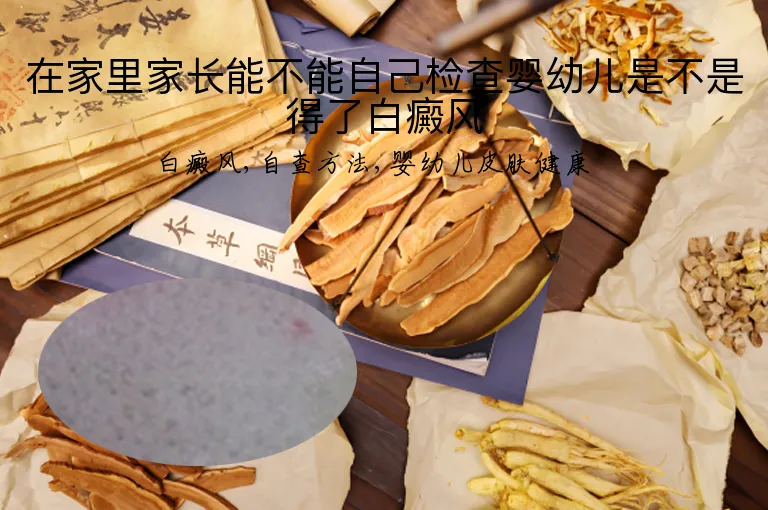 在家里家长能不能自己检查婴幼儿是不是得了白癜风