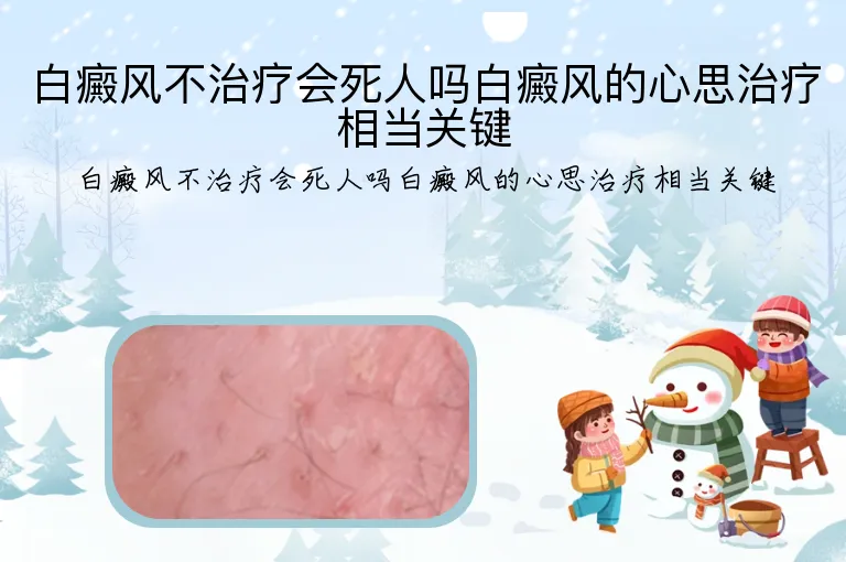 白癜风不治疗会死人吗白癜风的心思治疗相当关键