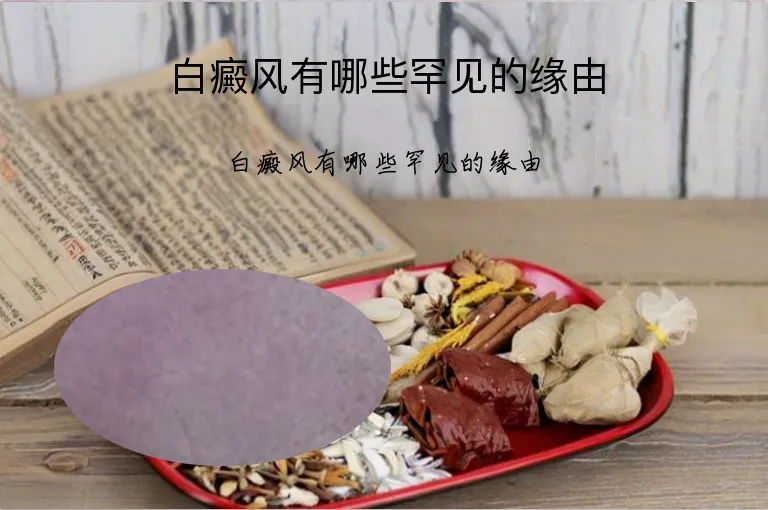 白癜风有哪些罕见的缘由