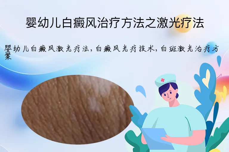 婴幼儿白癜风治疗方法之激光疗法