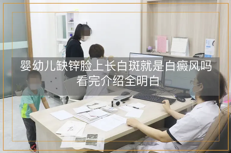 婴幼儿缺锌脸上长白斑就是白癜风吗 看完介绍全明白