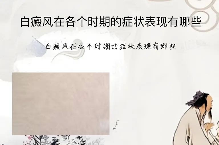 白癜风在各个时期的症状表现有哪些