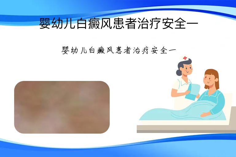 婴幼儿白癜风患者治疗安全一
