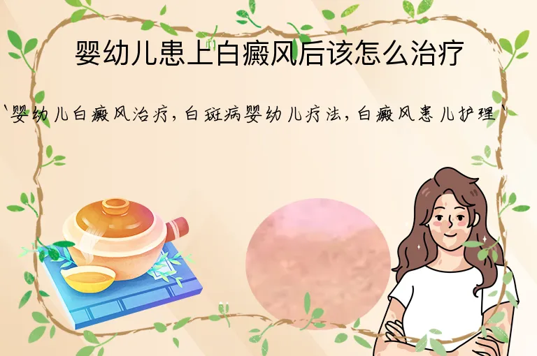 婴幼儿患上白癜风后该怎么治疗