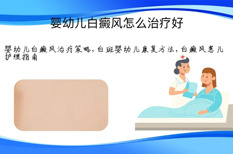 婴幼儿白癜风怎么治疗好