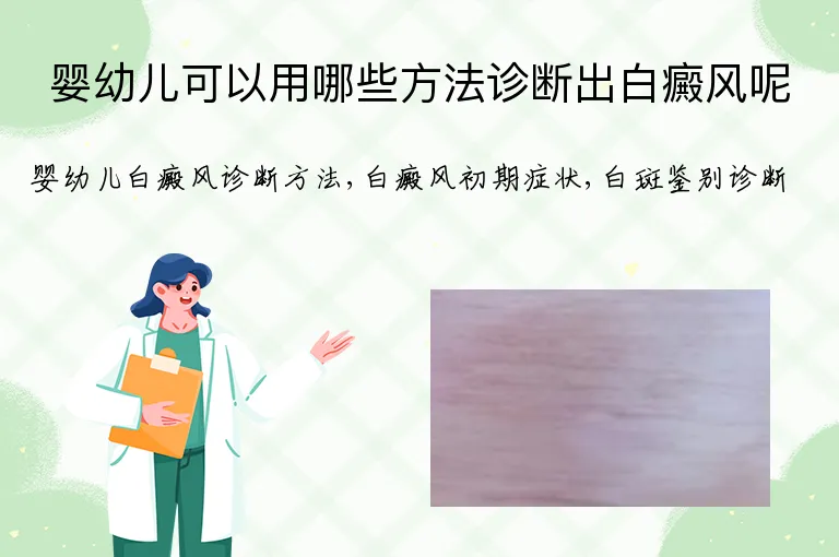 婴幼儿可以用哪些方法诊断出白癜风呢