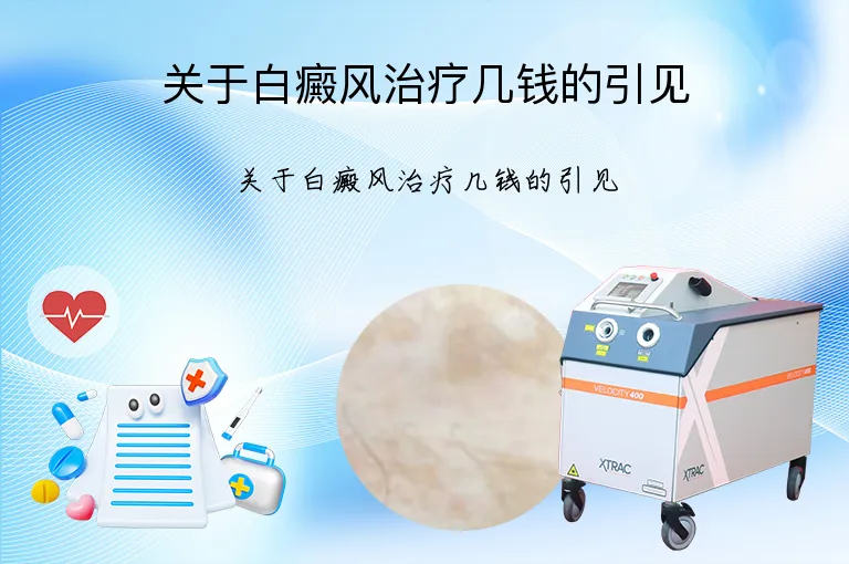 关于白癜风治疗几钱的引见