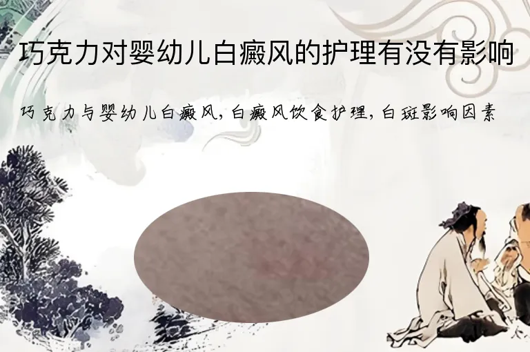 巧克力对婴幼儿白癜风的护理有没有影响
