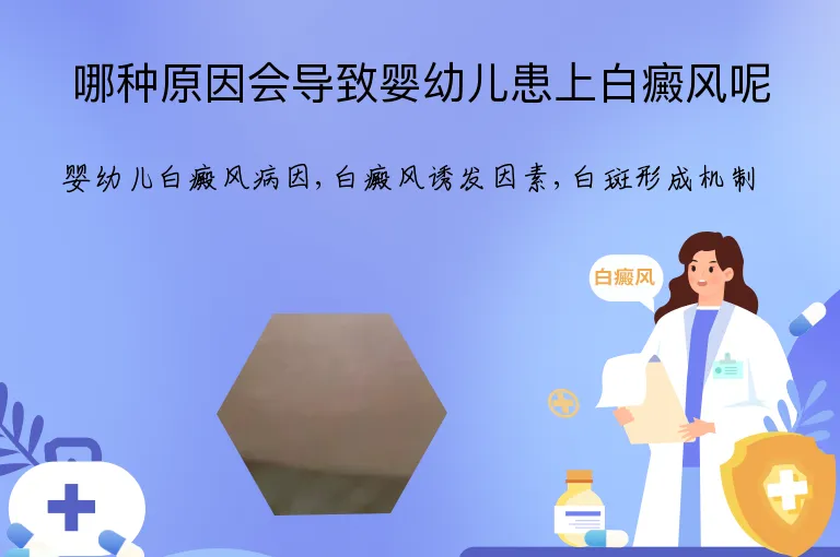 哪种原因会导致婴幼儿患上白癜风呢