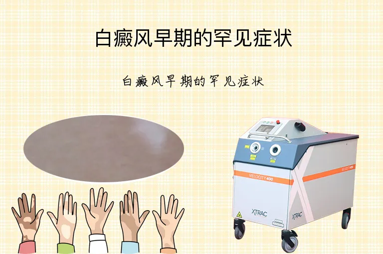 白癜风早期的罕见症状