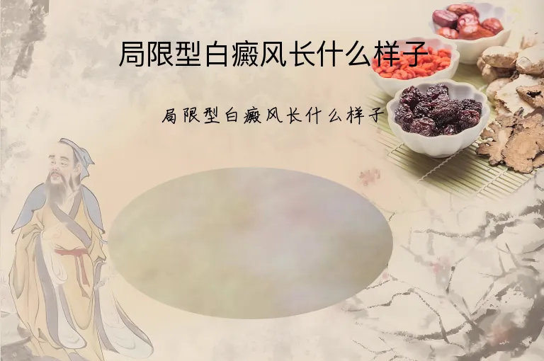 局限型白癜风长什么样子
