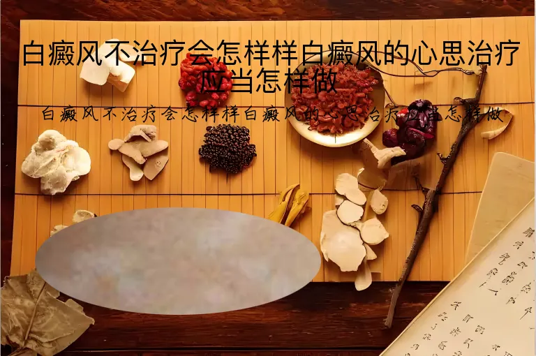 白癜风不治疗会怎样样白癜风的心思治疗应当怎样做