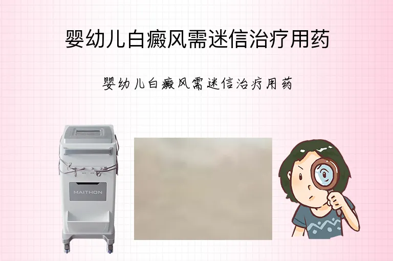 婴幼儿白癜风需迷信治疗用药