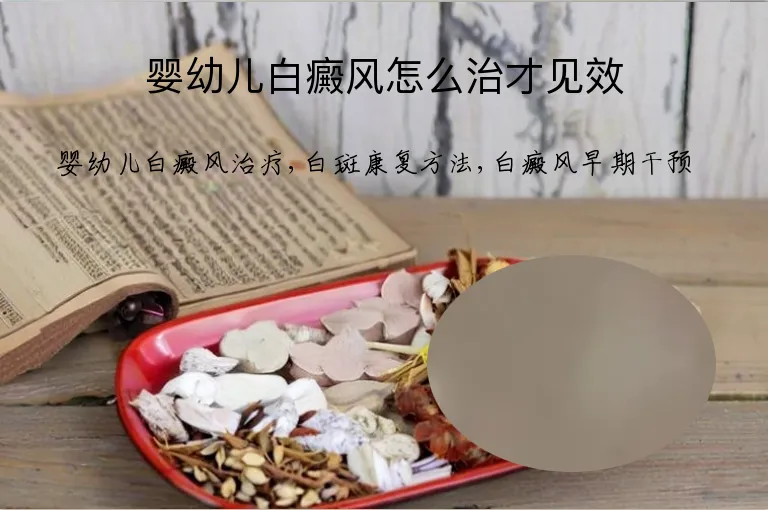 婴幼儿白癜风怎么治才见效