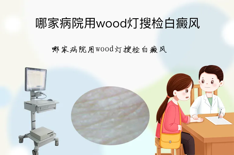 哪家病院用wood灯搜检白癜风