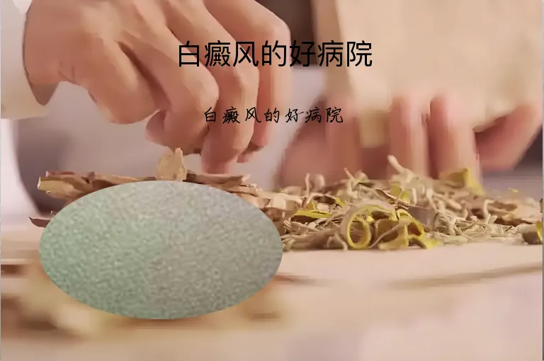 白癜风的好病院