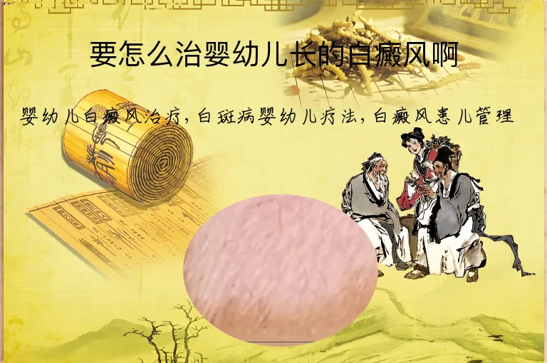 要怎么治婴幼儿长的白癜风啊