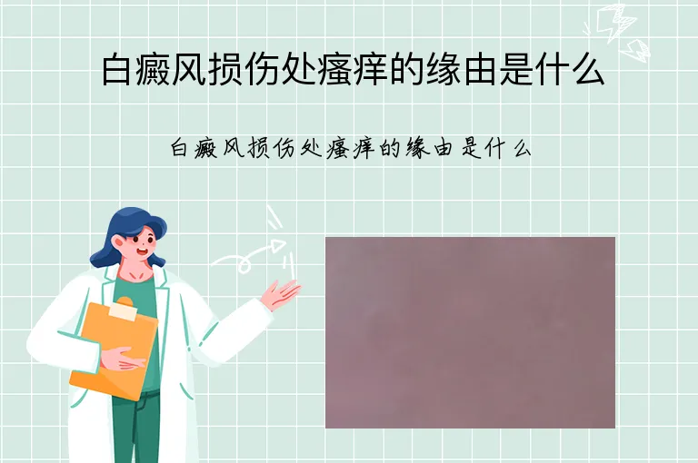 白癜风损伤处瘙痒的缘由是什么