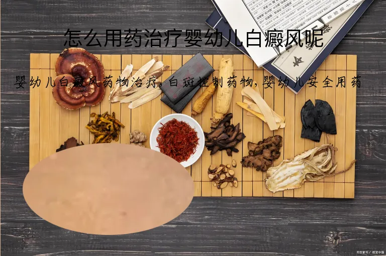 怎么用药治疗婴幼儿白癜风呢