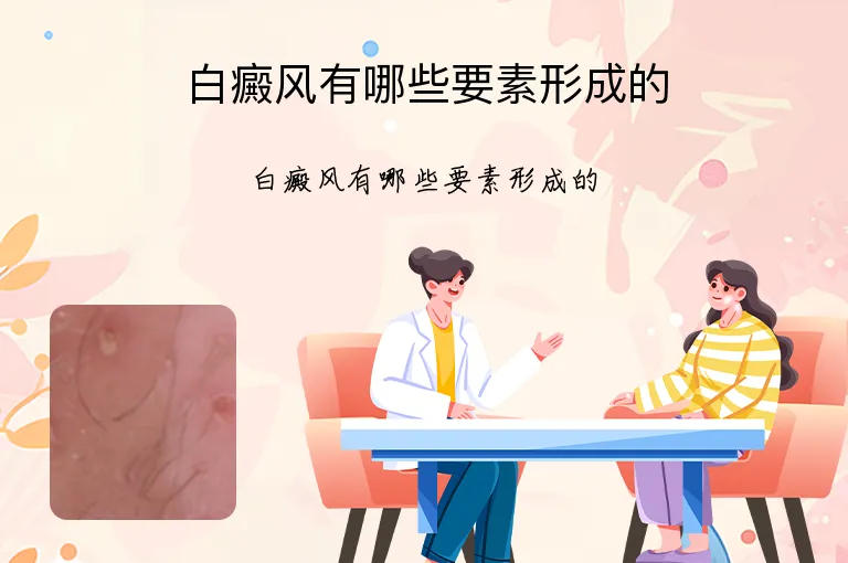 白癜风有哪些要素形成的