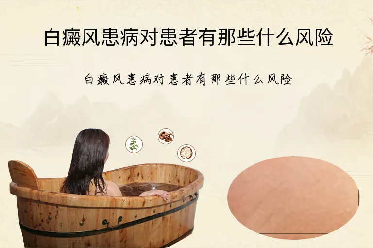 白癜风患病对患者有那些什么风险