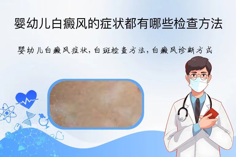 婴幼儿白癜风的症状都有哪些检查方法