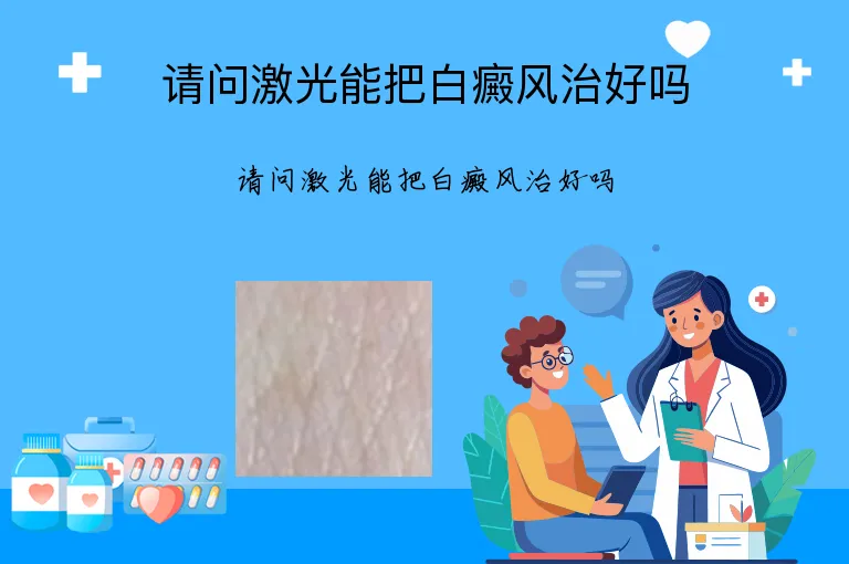 请问激光能把白癜风治好吗