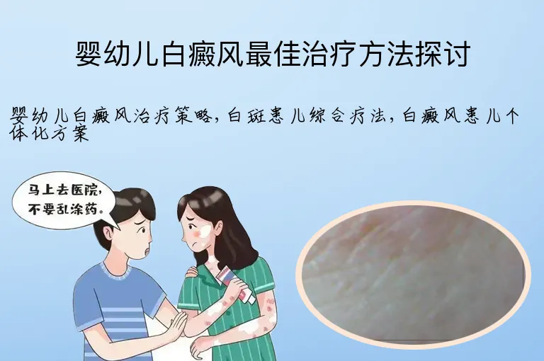 婴幼儿白癜风最佳治疗方法探讨