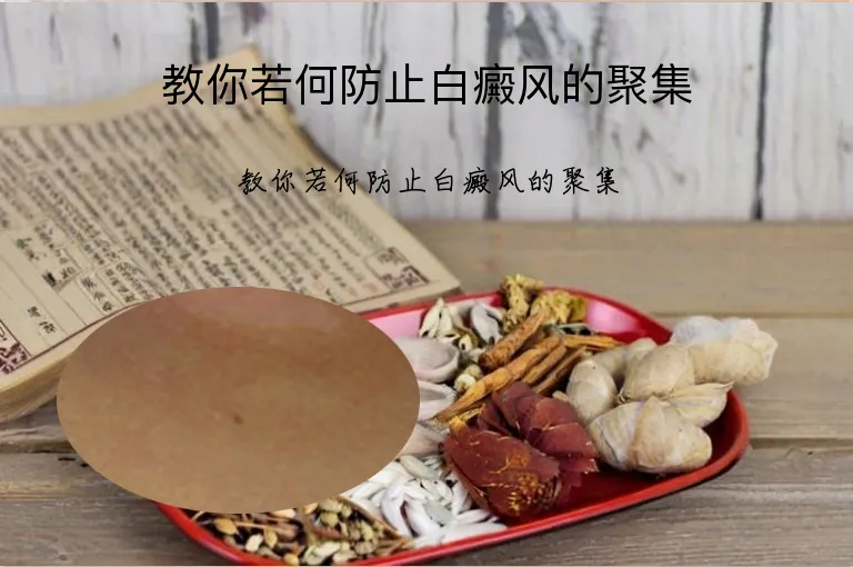 教你若何防止白癜风的聚集