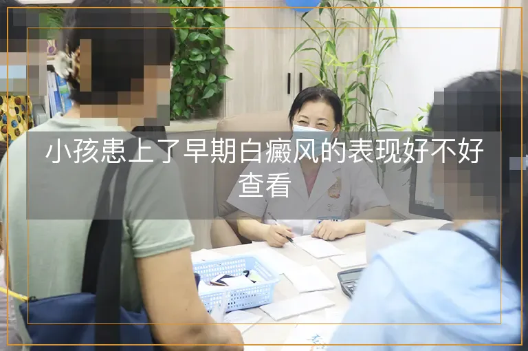 小孩患上了早期白癜风的表现好不好查看