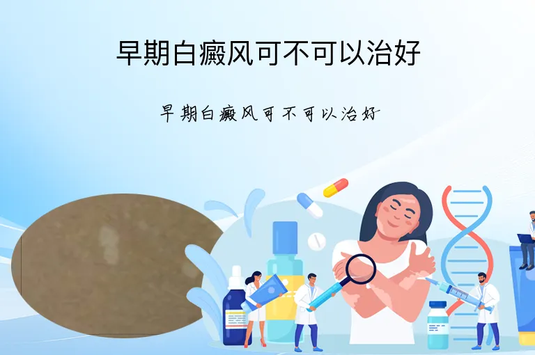 早期白癜风可不可以治好
