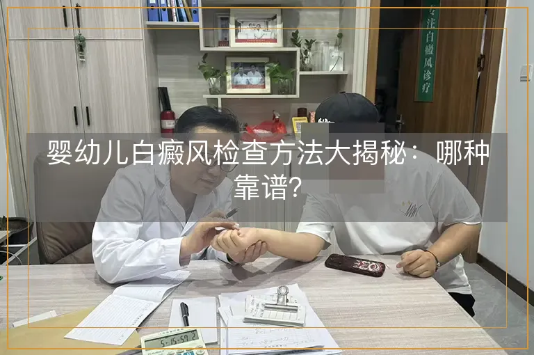婴幼儿白癜风检查方法大揭秘：哪种靠谱？