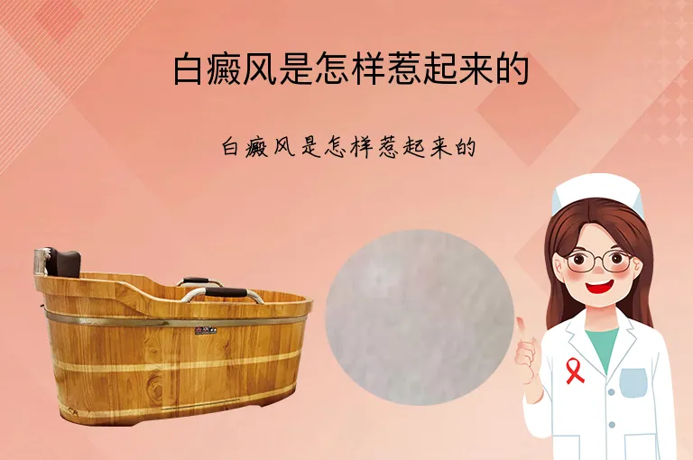白癜风是怎样惹起来的