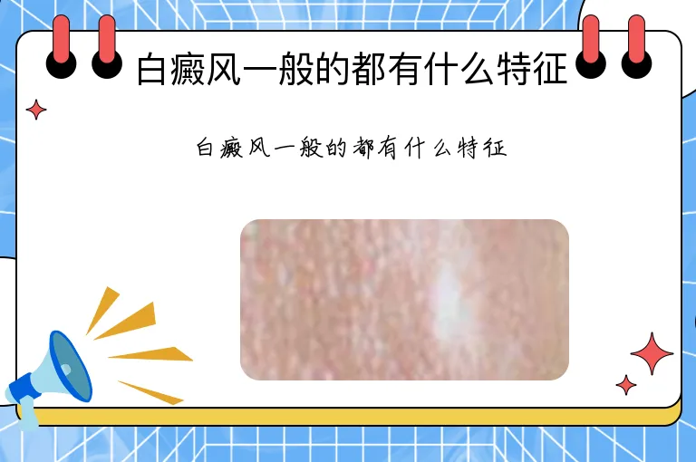 白癜风一般的都有什么特征