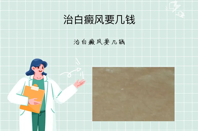 治白癜风要几钱