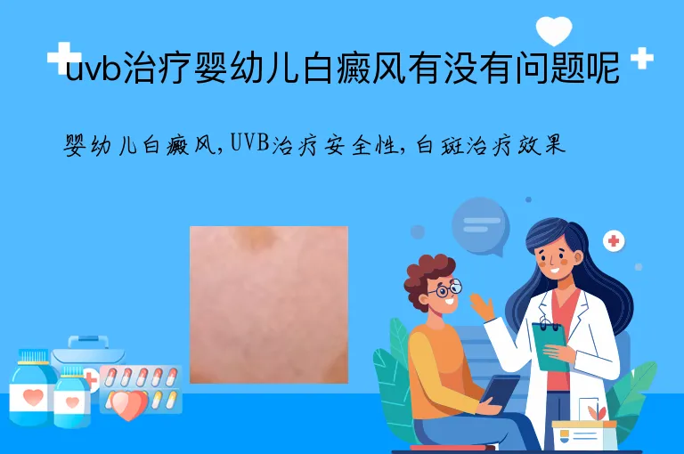 uvb治疗婴幼儿白癜风有没有问题呢