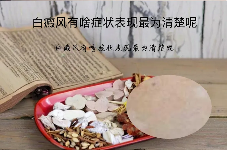 白癜风有啥症状表现最为清楚呢