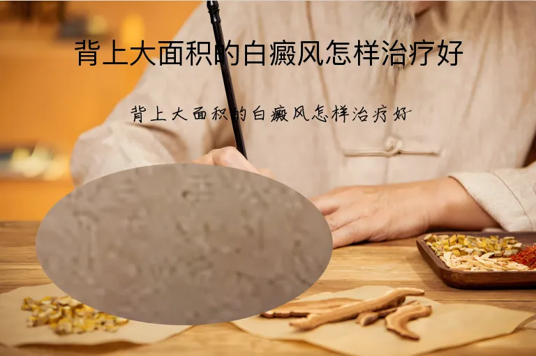背上大面积的白癜风怎样治疗好