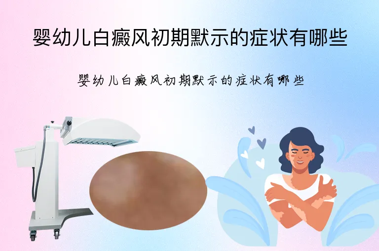 婴幼儿白癜风初期默示的症状有哪些
