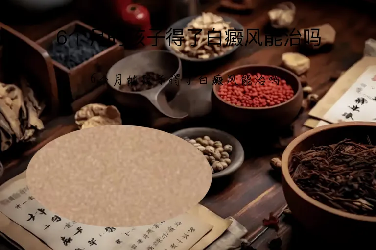 6个月的孩子得了白癜风能治吗