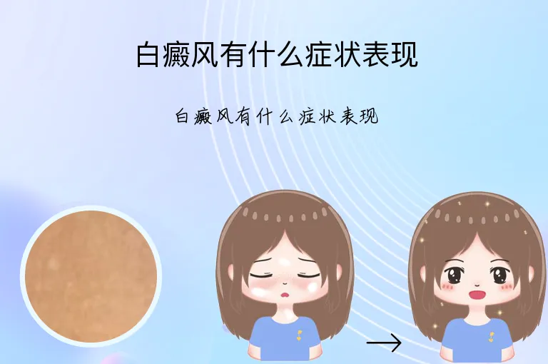 白癜风有什么症状表现