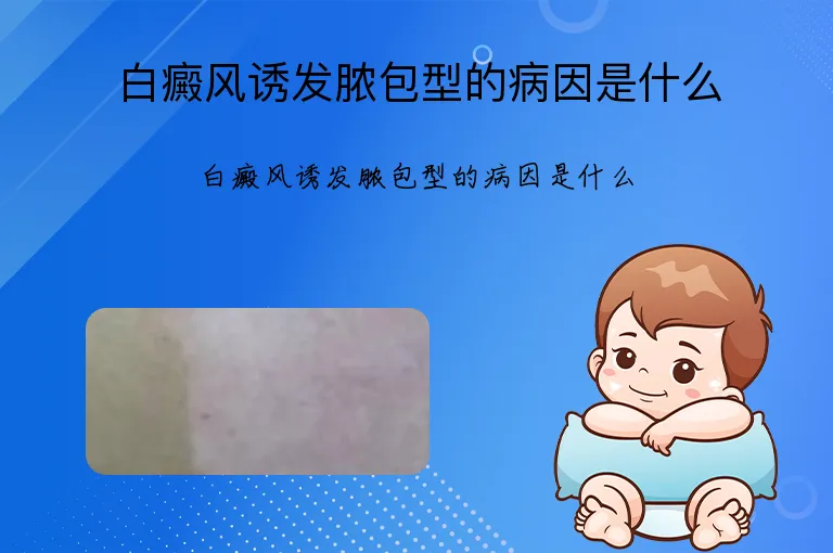 白癜风诱发脓包型的病因是什么