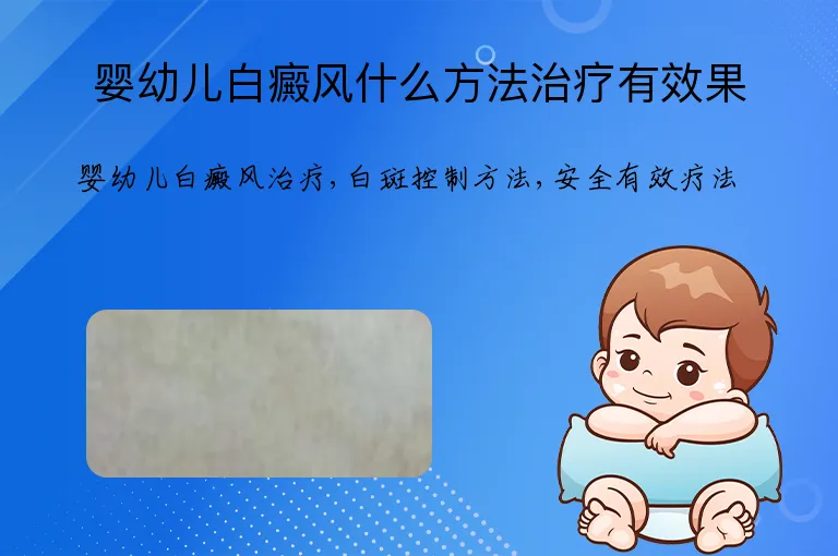 婴幼儿白癜风什么方法治疗有效果