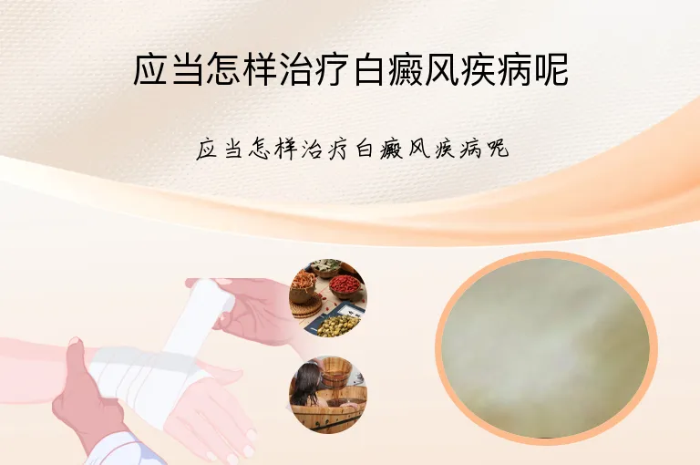 应当怎样治疗白癜风疾病呢