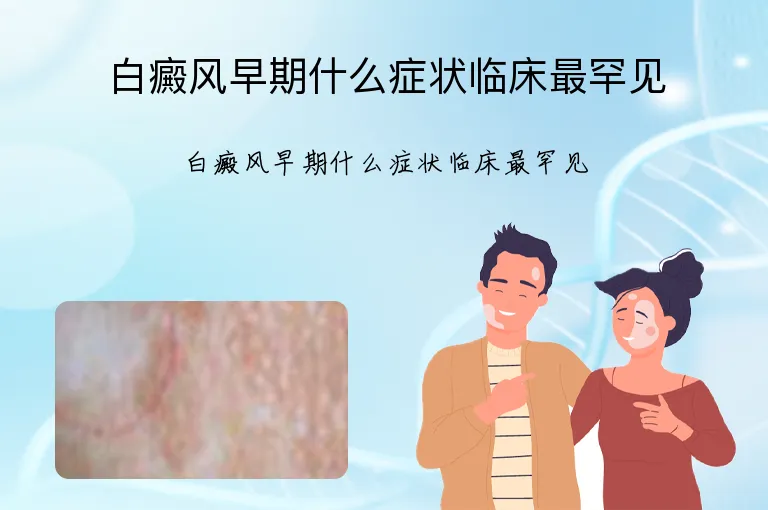 白癜风早期什么症状临床最罕见