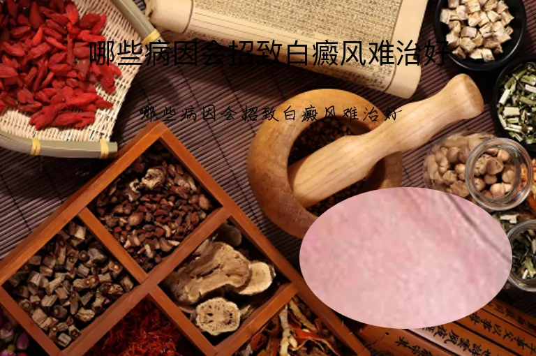 哪些病因会招致白癜风难治好