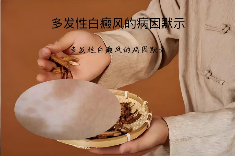 多发性白癜风的病因默示