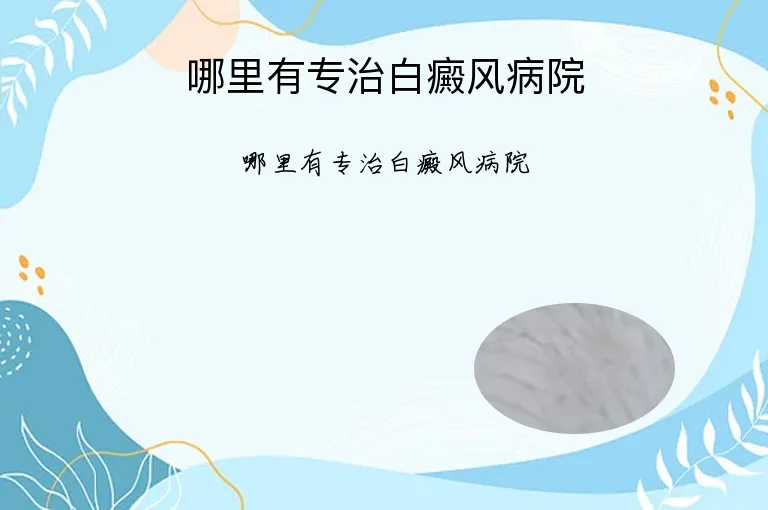 哪里有专治白癜风病院
